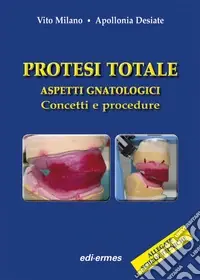 Professionale Protesi totale. Aspetti gnatologici. Concetti e procedure
