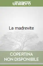 La madrevite Miglior Prezzo