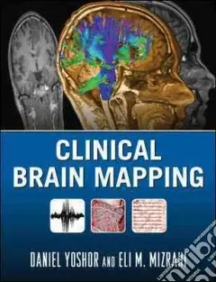 Clinical Brain Mapping Solo Oggi