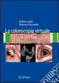 La colonscopia virtuale Novità