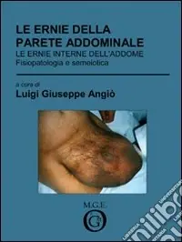 Offerta Lampo Le ernie della parete addominale. Le ernie interne dell‘addome. Fisiopatologia e semeiotica